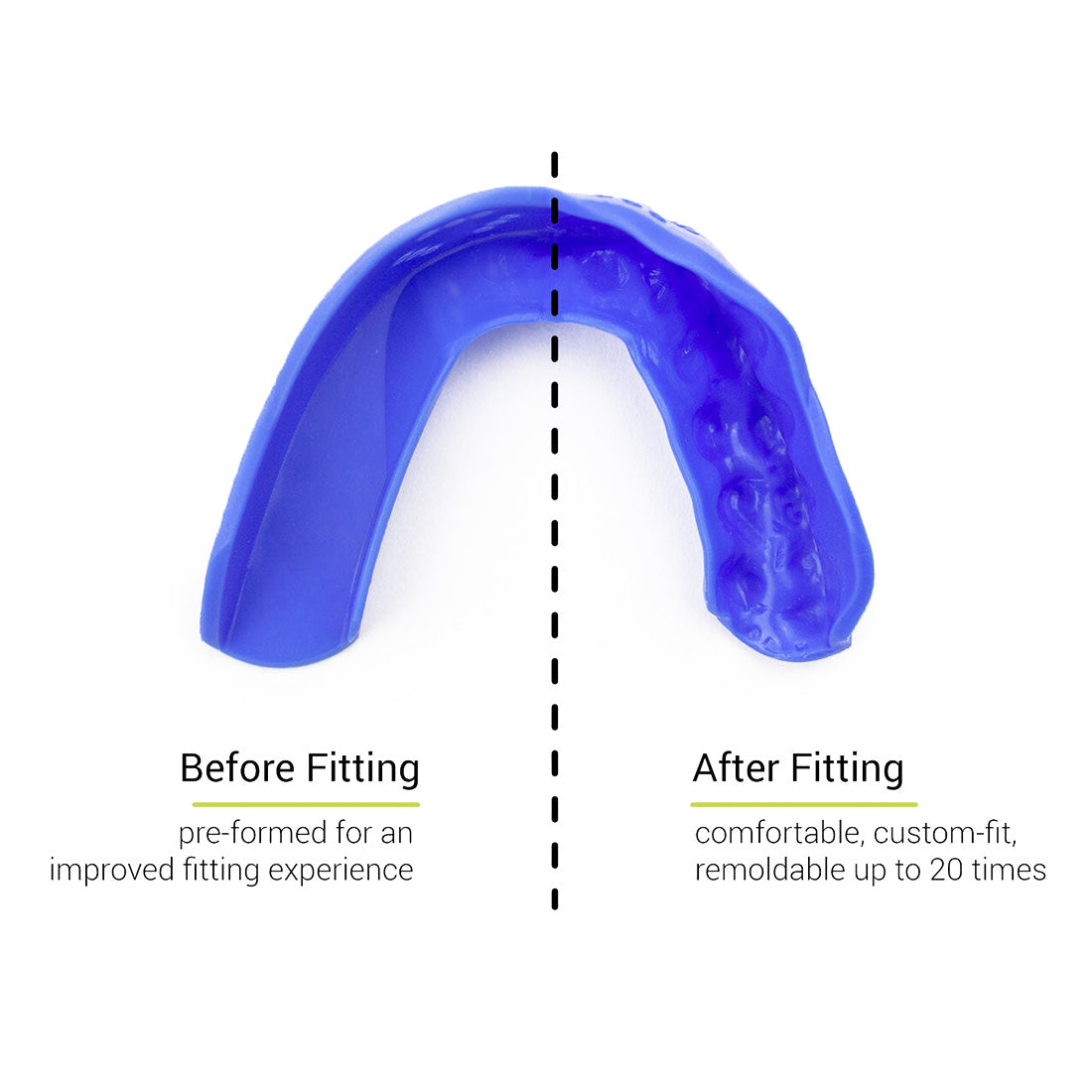 SISU 3D Adult Mouthguard Protective Mouthguards